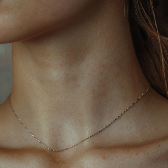 Arrugas del cuello: por qué suceden y cómo deshacerse de ellas